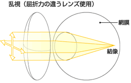 img_astigmatism02.gif