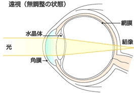 遠視あ.gif