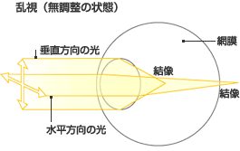乱視あ.gif